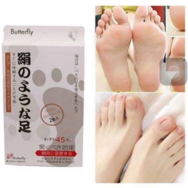 Butterfly Japan Foot Peel showing results on feet