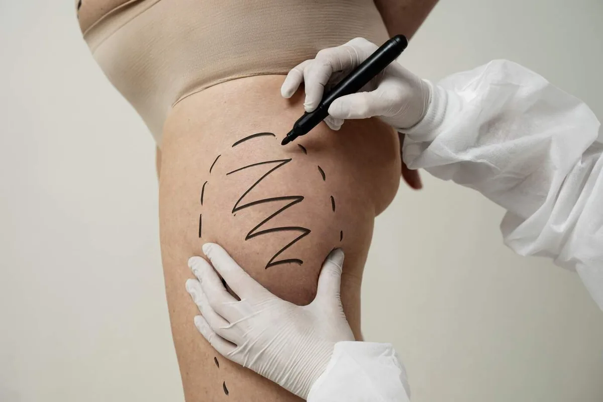 cosmetic surgery cost
