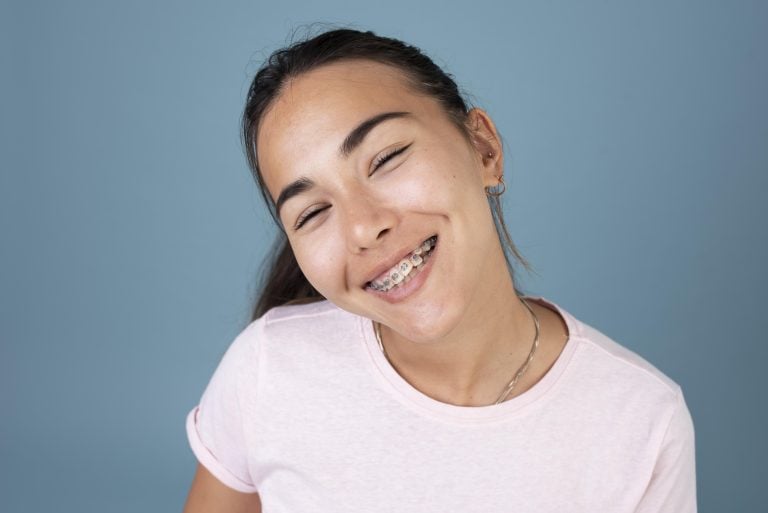 Traditional vs Ceramic vs Lingual Braces: Which Type Is Best in the Philippines?