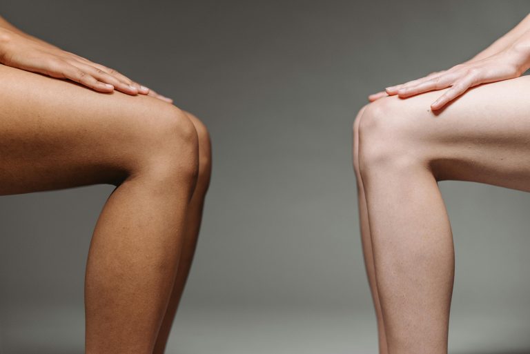 How to Lighten Dark Inner Thighs